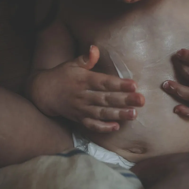 Lotion 100 ml. Plejemidler